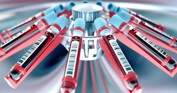 Study uncovers role of genetic variants in blood cancer development  tinyurl.com/ykfhzkz5