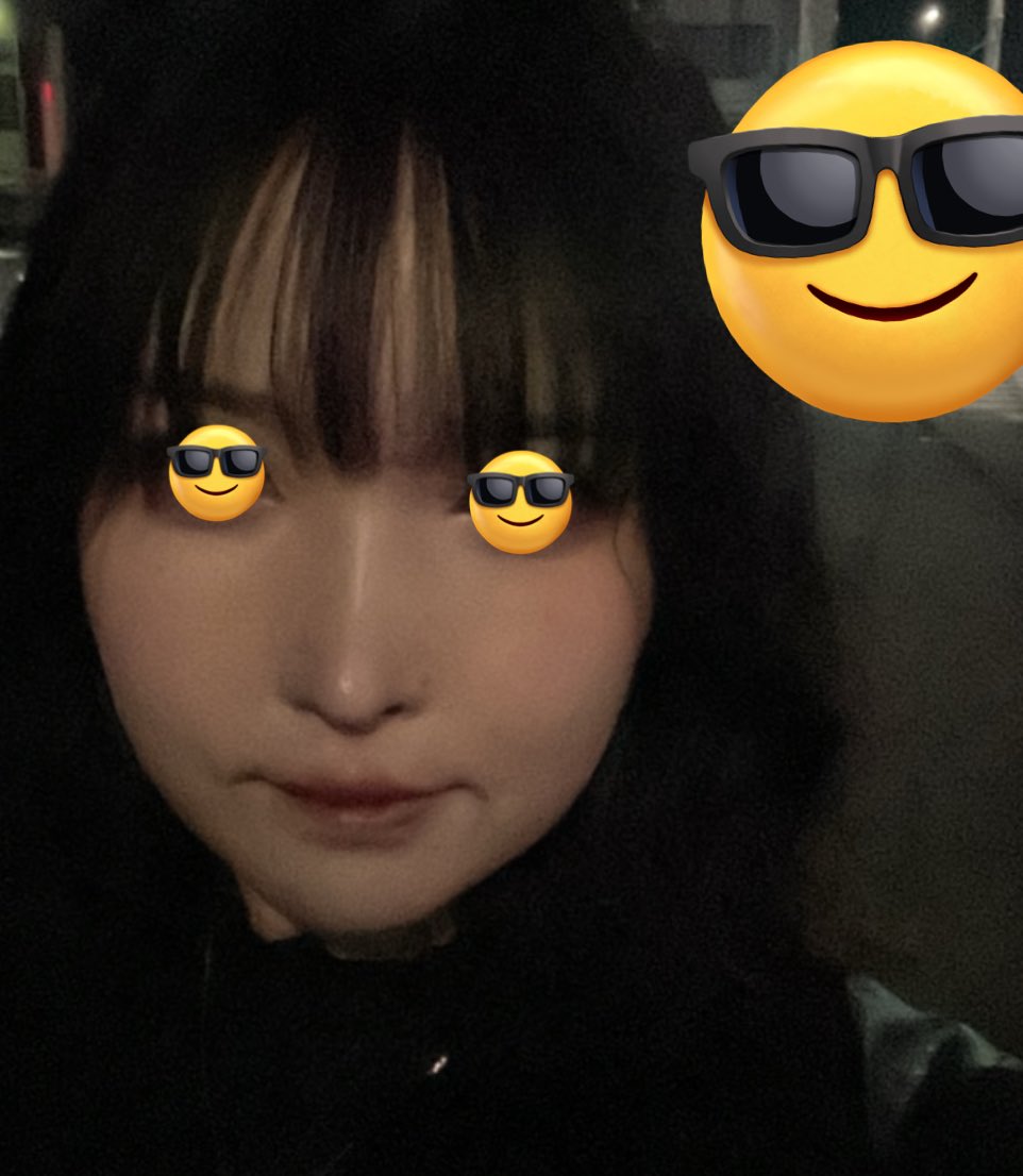 mochimarumemo's tweet photo. アーバンでやった鼻整形(➕その他諸々)9ヶ月経過！
感染も炎症もなく鼻整形したことを忘れるくらいナチュラルで綺麗🫶
でもbeforeと比べるとびっくりするくらい変化あって感謝しかない🥹👍🏻 https://t.co/PYTcflFtgG