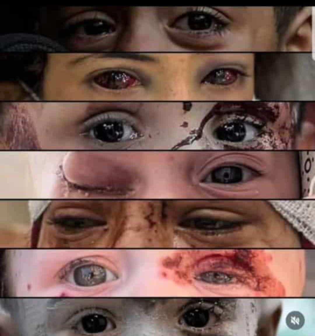 Dlbrokty's tweet photo. Gözler de konuşabilir.. #GazaStarving‌‌ #GazzedeKatliamVar https://t.co/zI1UBdHgz4