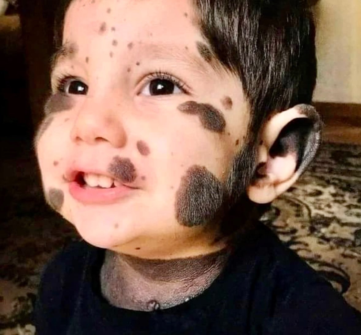 _brainsofweb3's tweet photo. If his skin condition doesn't bother you, repost and  Leave a HEART ❤️ https://t.co/7hK6QZfeJ6