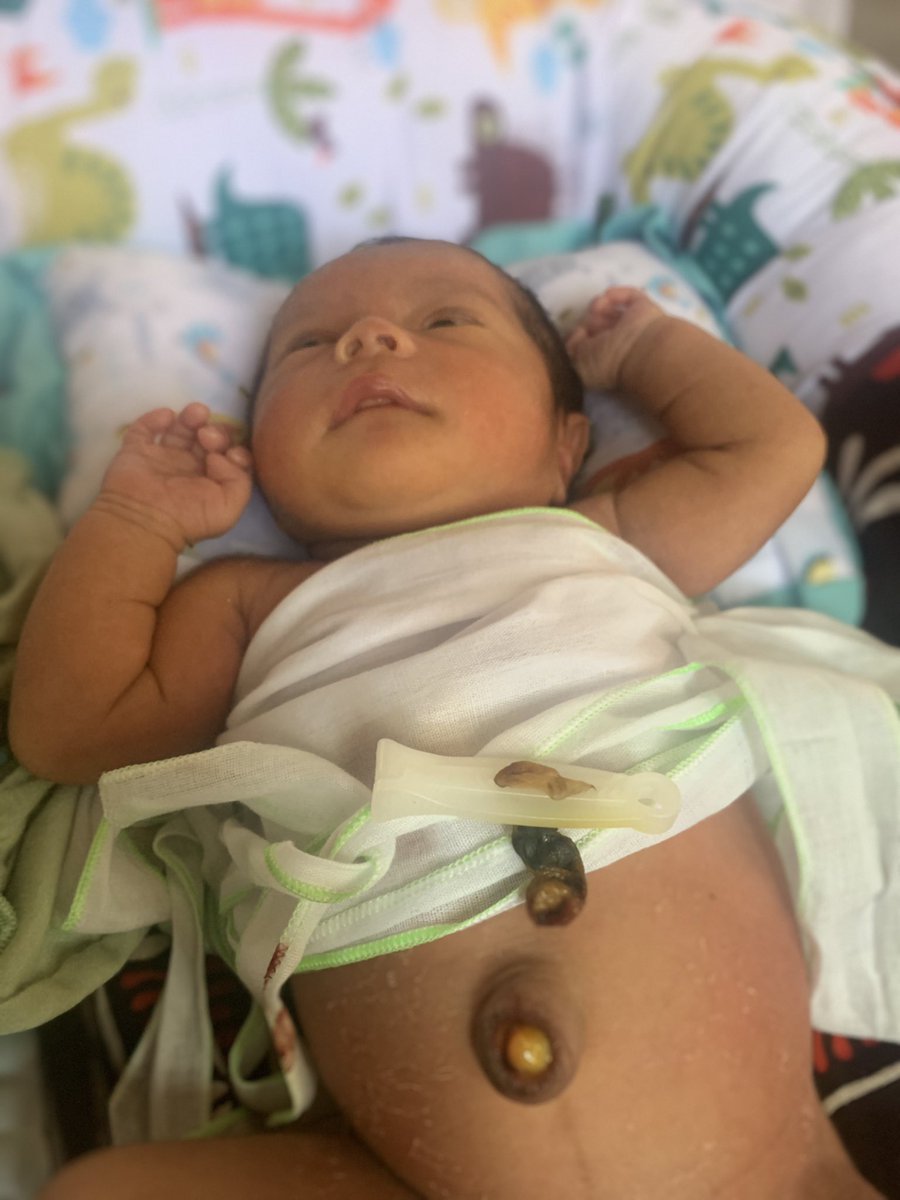 rossatililma's tweet photo. Umur kmu hari ini 7hari 🥹
- pusar kmu uda lepas
- sedikit syukuran pemberian nama ( REYNALA KESHWARI)
- sedikit tradisi naik ayun &amp; sunat 

Semua ingin lakukan yg terbaik untuk kmu 🥲 https://t.co/ecfVtfxO8j