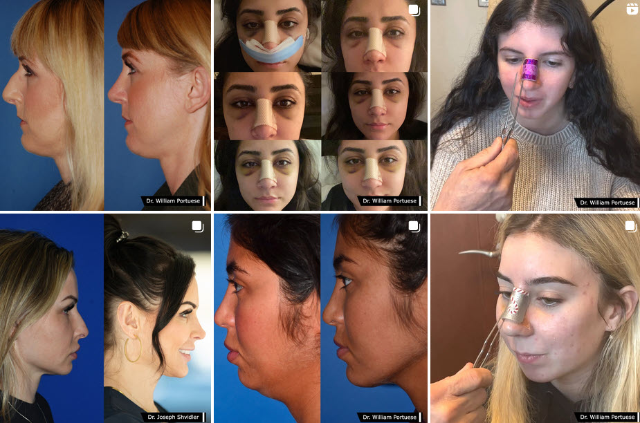 The Portland Center for Facial Plastic Surgery tweet media