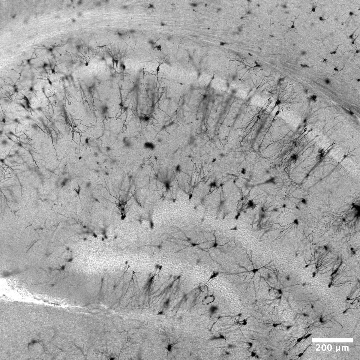 #MicroscopyMonday - 150 years ago, #CamiloGolgi developed the Golgi stain, used by #SantiagoRamonyCajal to reveal neuronal structure. Here's a Golgi-stained section from #SwayneLab & #ReynoldsLab Honours student Mareya Valeya imaged with confocal microscopy! @DrLARey @dr_swayne