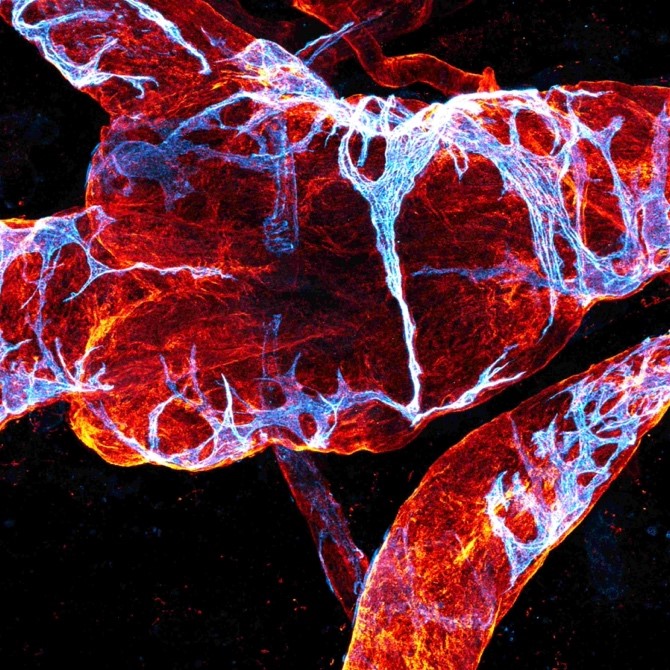 EVB_Org's tweet photo. Our studies @makinenlab are focused on the lymphatic vasculature, which is essential for fluid homeostasis, immune cell trafficking and intestinal absorption of lipids - and increasingly recognized as a multifaceted regulator of various organ functions. https://t.co/Zaf0Emwjn0