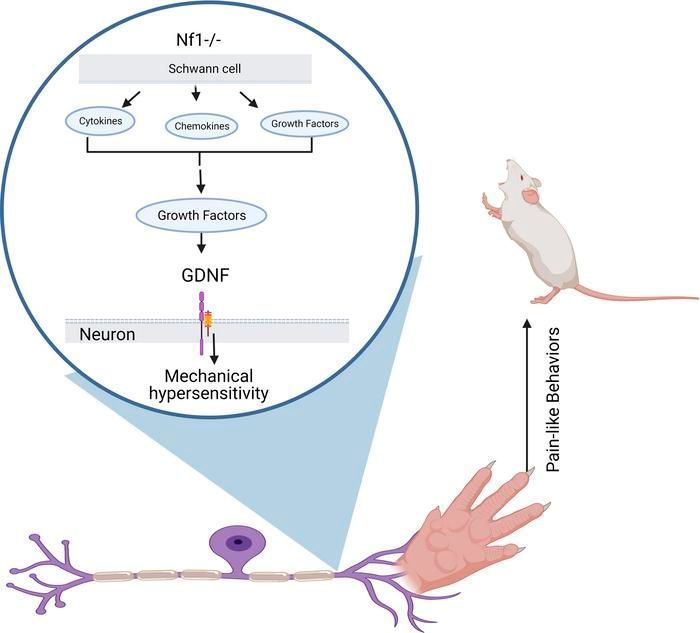 JCI insight (@jci_insight) on Twitter photo Schwann cells modulate nociception in neurofibromatosis 1: buff.ly/3UwBPfJ
<a href="/CincyChildrens/">Cincinnati Children's</a>
#Neuroscience Schwann cells modulate nociception in neurofibromatosis 1: buff.ly/3UwBPfJ
<a href="/CincyChildrens/">Cincinnati Children's</a>
#Neuroscience