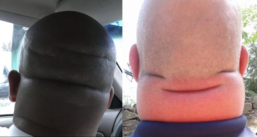 This is what you would look like if you were black or Asain