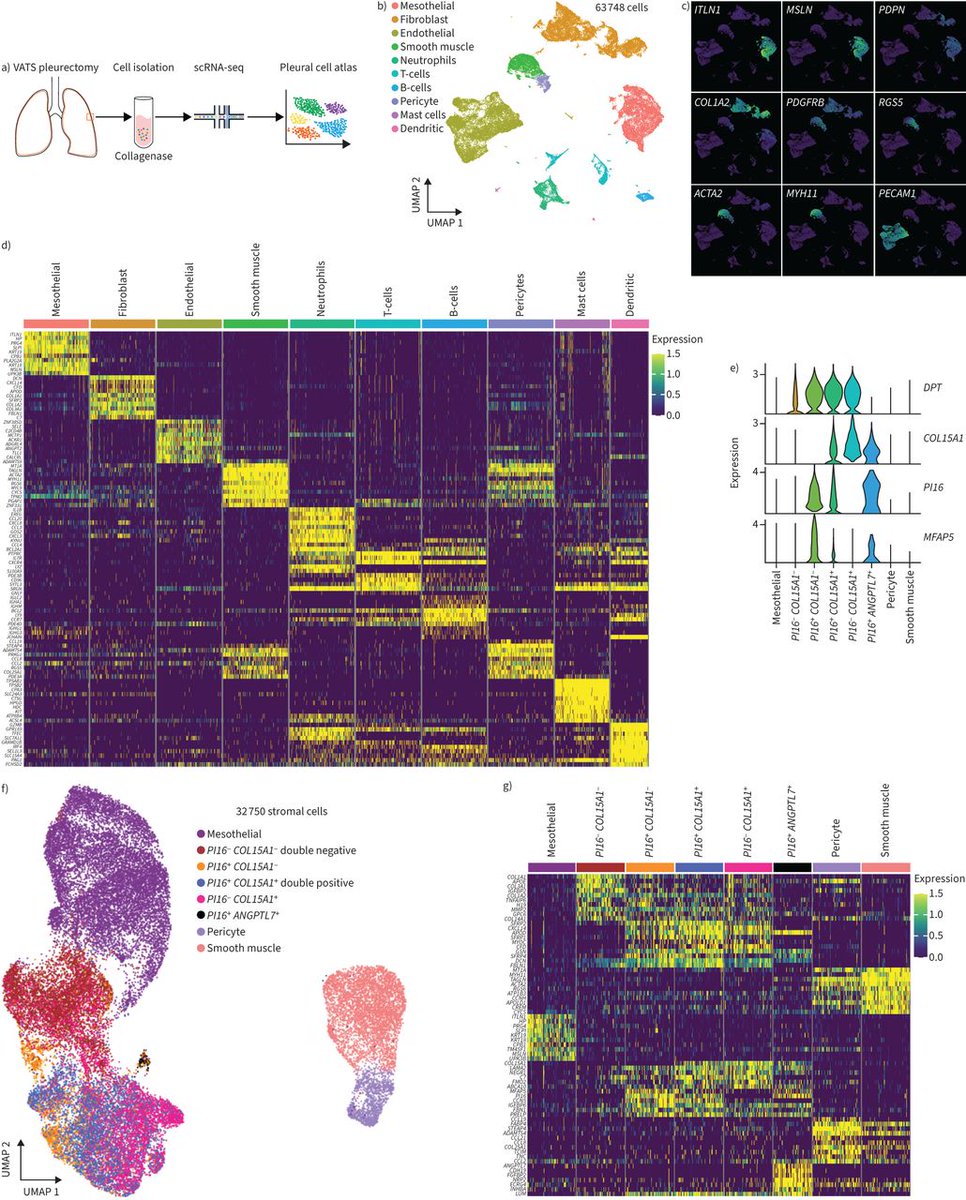 European Respiratory Journal: The first single-cell RNA-seq atlas of human parietal pleura is now accessible via a free web-based data-mining tool, MesothelialCellAtlas.com, and illuminates aspects of benign and malignant pleural biology bit.ly/3u3eDu8