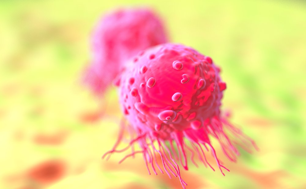 Revolutionizing Glioma Treatment: Explore how targeting mutant IDH is opening new avenues in treating low-grade glioma

Stay informed on the cutting-edge of neuro-oncology. 

touchoncology.com/neuro-oncology…

#GliomaTreatment #MedicalInnovation