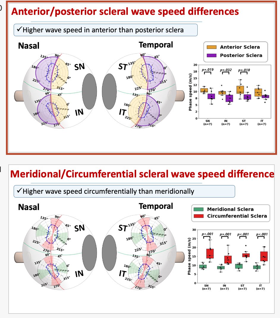 Snapshots of our talk ⁦<a href="/PhotonicsWest/">SPIE Photonics West</a>⁩ on #scleral #OCE #biomechanics: sclera is stiffer posteriorly than anteriorly, and circumferentially than meridionally. Insights for #myopia? ⁦<a href="/MarcoslabUr/">MarcosLab_UR</a>⁩ ⁦<a href="/LupeVillegasL/">Lupe Villegas</a>⁩ et al ⁦<a href="/VioBioLab/">VioBioLab</a>⁩ ⁦⁦<a href="/SPIEtweets/">SPIE</a>⁩