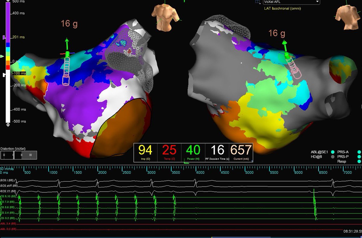Brandon Miller tweet media