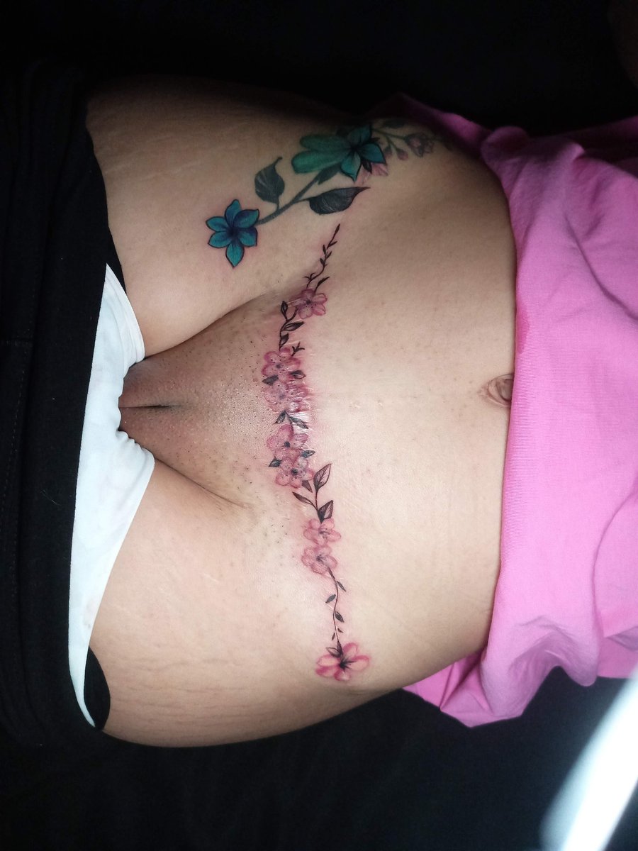 SWcukold_tattoo's tweet photo. Unas flores para ocultar tu cicatriz
Tienes alguna cicatriz que no te gusta
Manda mensaje
Nos encontramos en Azcapotzalco https://t.co/u1tp9R4j6z