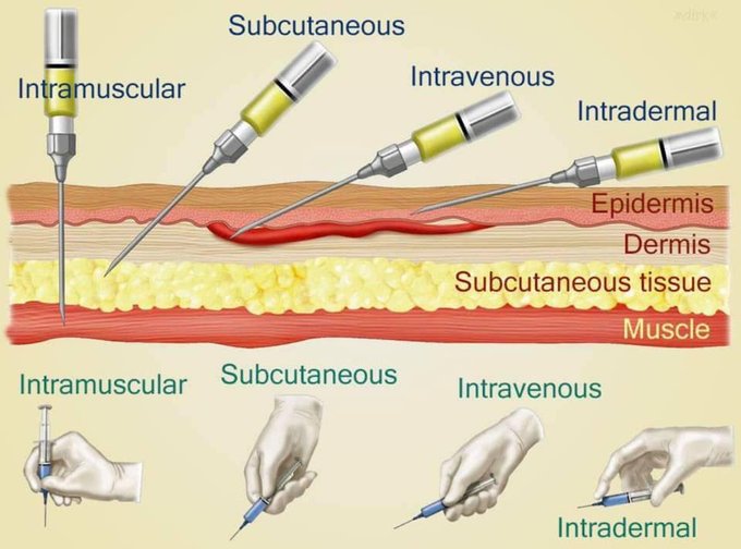 Do you know the difference?

Intramuscular (IM) is used to deliver a medication deep into the muscles.  This allows the medication to be absorbed into the bloodstream quickly.  IM injections are absorbed faster than Sub-Q injections because muscle tissue has a greater blood