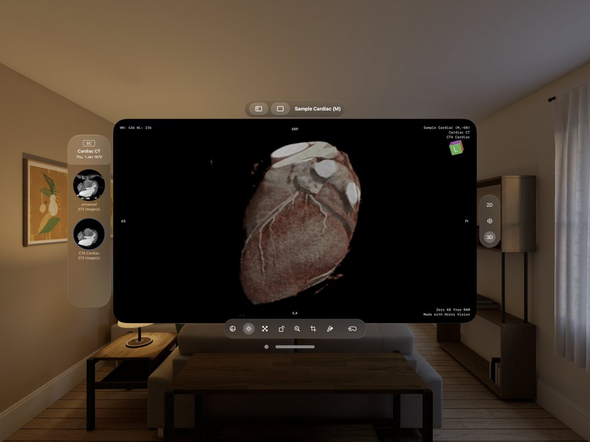 falcon_vue's tweet image. 🌟 Unveiling Falcon Vue: The world’s first spatial DICOM Viewer! Experience unparalleled 3D visualization, designed for healthcare excellence. #falconVue #MedicalImaging #Innovation #AppleVisionPro