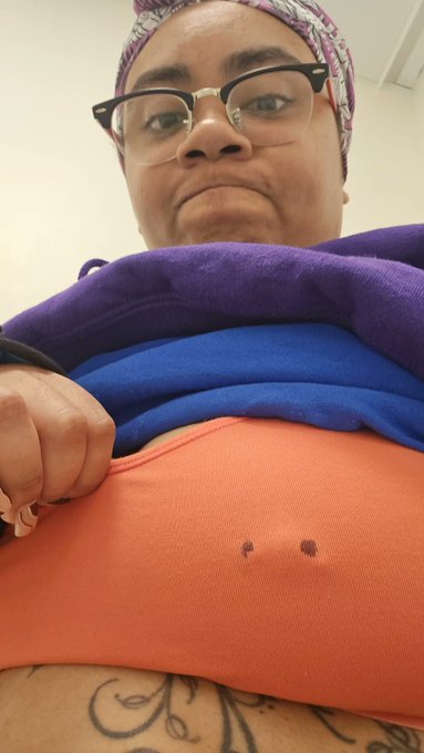 And here is why they say to be CAREFUL when you get piercings, from grabbing a package and it tapping