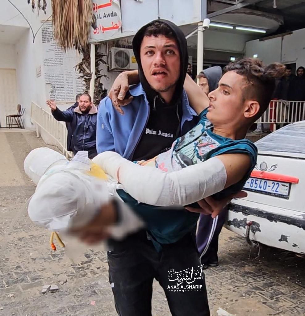 islamasalya88's tweet photo. Yaralı bir Filistinli, işgalcilerin Gazze'nin kuzeyini bombalaması nedeniyle vücudunun yarısını kaybetti. Hastaneler ve tıbbi noktalar arasında mekik dokuyor adeta. Öyle ki, tedavi olamıyor, seyahat edemiyor ve çektiği acı her geçen gün daha da artıyor. https://t.co/34UxPaXwNq