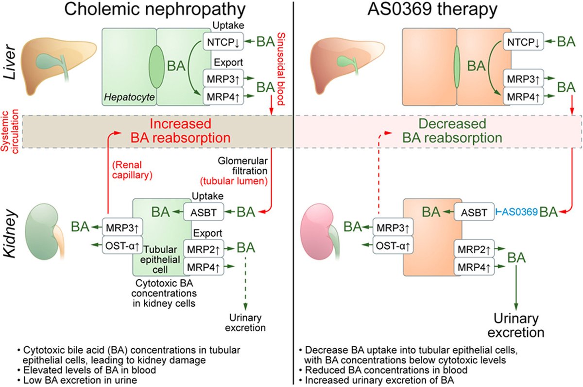 Altering #BileAcid pathways as a therapeutic strategy for #CholemicNephropathy #OpenAccess👉bit.ly/3UBLC4b #LiverTwitter