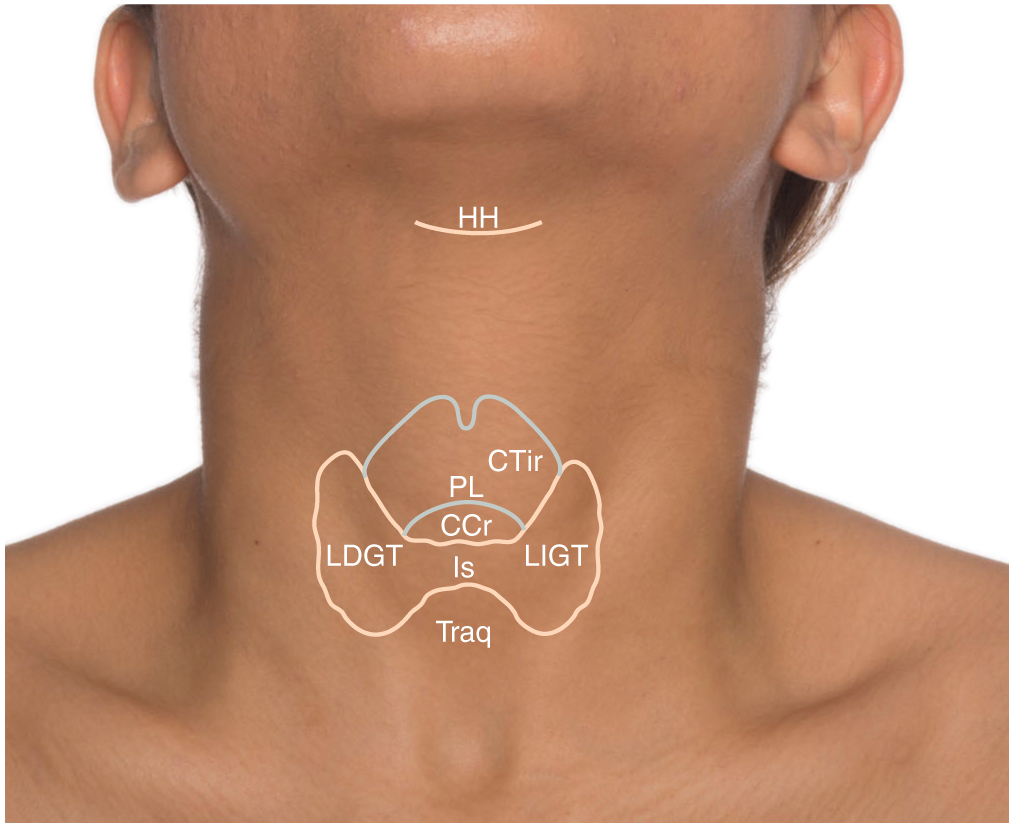 Anatomía De La Superficie Tiroidea