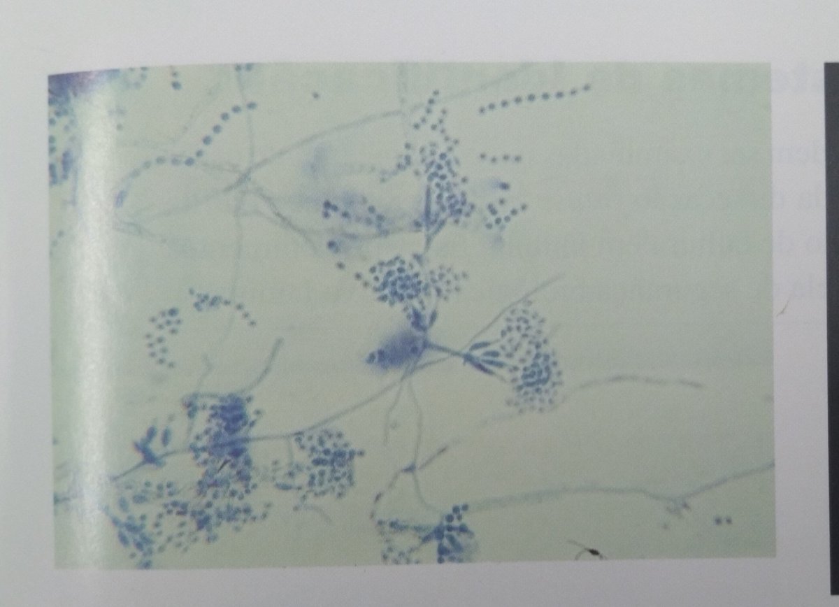 rkstudy_'s tweet photo. Penicillium 🧐🧐🧐 https://t.co/dW30jHx4fg