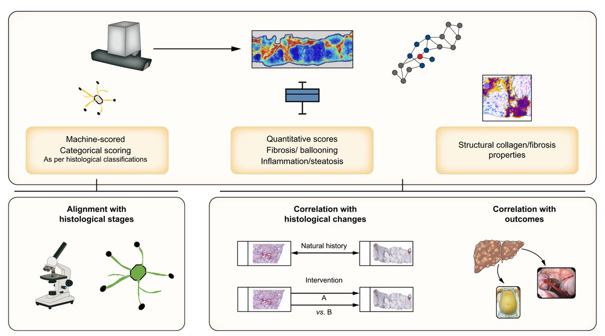 ✅Artificial intelligence-assisted digital pathology tools ✅Regulatory considerations ✅And their impact ➡️On NASH management & drug development Full review here👉journal-of-hepatology.eu/article/S0168-… @ArunJSanyalVCU #LiverTwitter