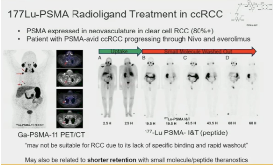 The emergent role of theranostics in #RenalCellCarcinoma. Presentation by @KidneyCancerDoc @UCLA. #GU24 written coverage by @RKSayyid @UofT > bit.ly/3SB5DWR @ASCO