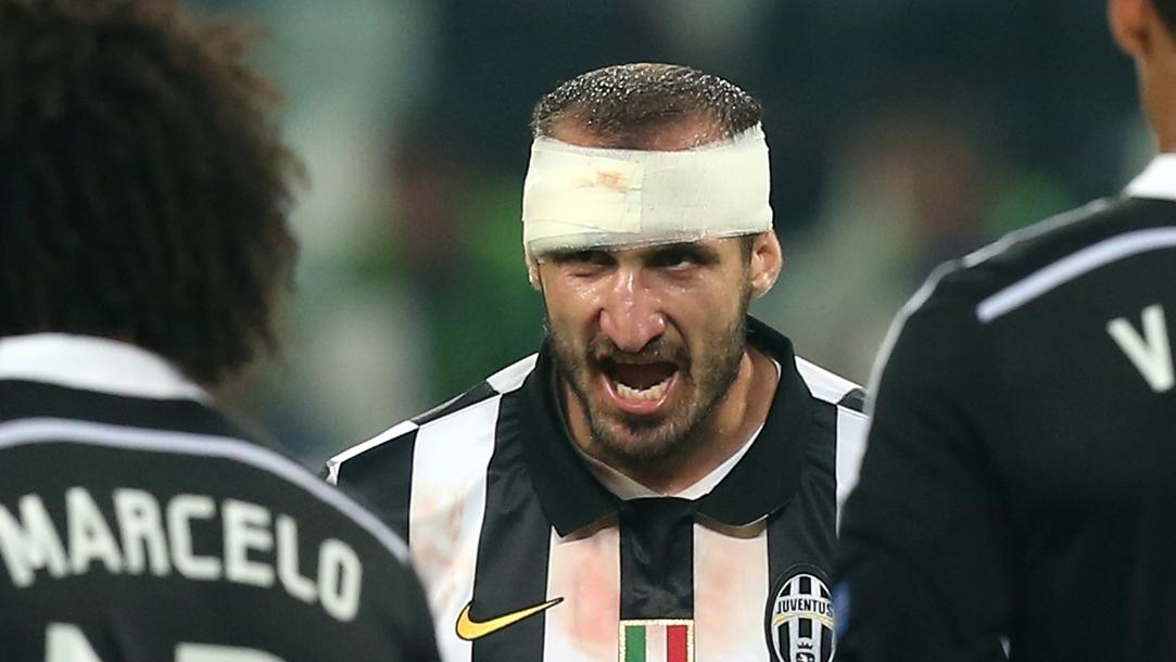breinerca1107's tweet photo. A Pesar que Anoche @nacionaloficial jugo un partido horrible, veia a Bernado ensangrentado como un pvtas, me acordé de esta leyenda como lo era "Giorgio Chiellini" que defensa para hacerse respetar y matar por su equipo. https://t.co/ByQmsI1aBU