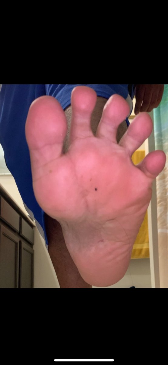 CarlosPrince00's tweet photo. @FeetFinder Heydudes no socks 👃👃👃🦶🦶🦶🤢🤢🤢 https://t.co/204iCQc4ie