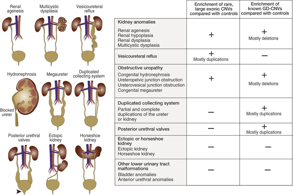 KIReports's tweet photo. 6) #CAKUT comprises:
Congenital #hydronephrosis
Multicystic dysplastic kidney (#MCDK)
Renal agenesis
Renal duplication
Renal dysplasia
Crossed fused renal ectopia
Ectopic kidney & lower urinary tract anomalies https://t.co/fXFbVGu3qH