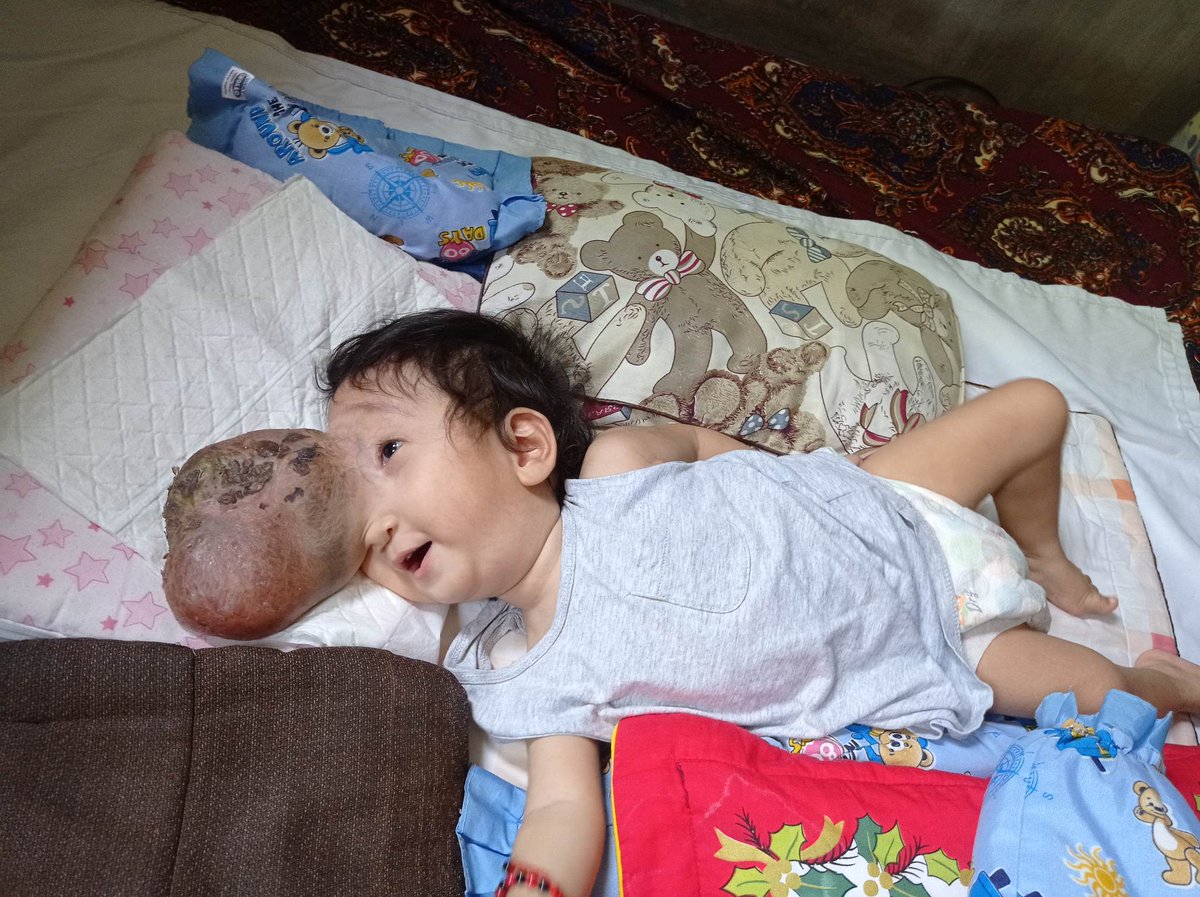 It takes 0 seconds to repost this tweet, please share. 

Please help us raise ₱15,000 ($300) for Baby Ace. 
The funds will be used to send him to hospital, initial laboratories and his basic needs. (milk, diapers)

The family is struggling with the medical expenses and your help