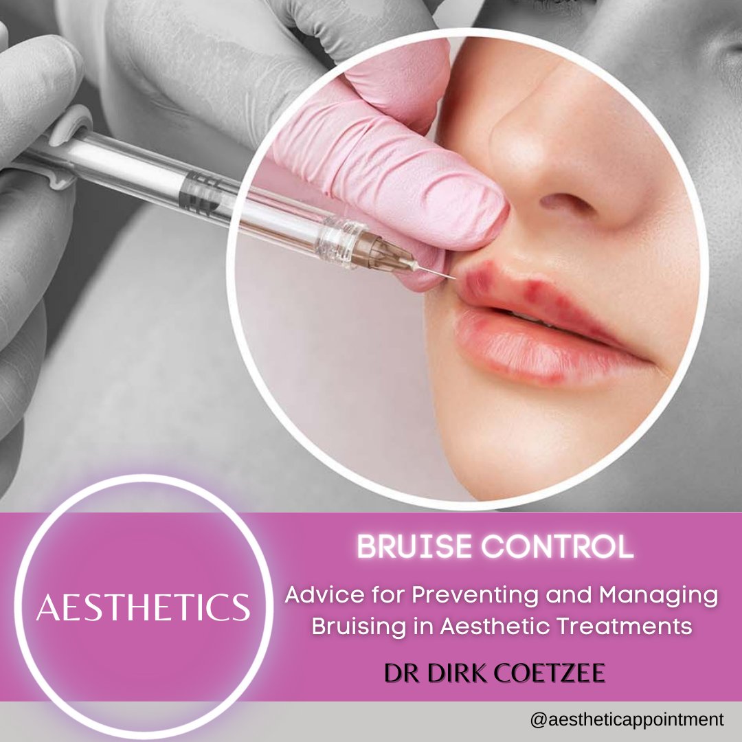 Dr Dirk Coetzee shares insights on preventing and managing the often-ignored issue of bruising from aesthetic injections 

aestheticappointment.co.za/2024/01/bruise…

#AestheticAppointment #DrDirkCoetzee #BruisePrevention #AestheticMedicine #BruiseControl