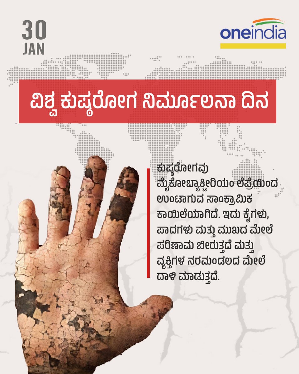 OneindiaKannada's tweet photo. ವಿಶ್ವ ಕುಷ್ಠರೋಗ ನಿರ್ಮೂಲನಾ ದಿನ...
#WorldLeprosyDay #eradicationday #worlddays #india https://t.co/BkEPFJwWkN