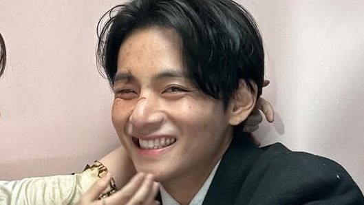 skiestete's tweet photo. fav smile<3 https://t.co/qh3wxXBgrK