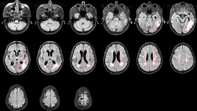Radiology: Artificial Intelligence tweet media