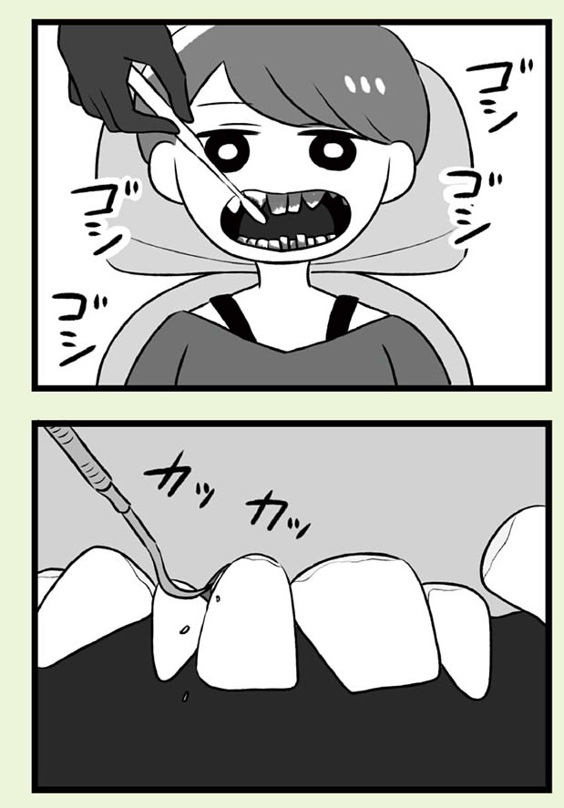 自分を好きになるために歯列矯正をして歯並びを治す話⑨ 歯肉炎治療編(5/5)

恐怖のキュイイン!続きはこちらで読めます👇
歯肉炎の治療で口の中が血だらけに!?厳しい指導のもと歯磨きの難しさを痛感【作者に聞く】
https://t.co/o9LtO6KW2K 