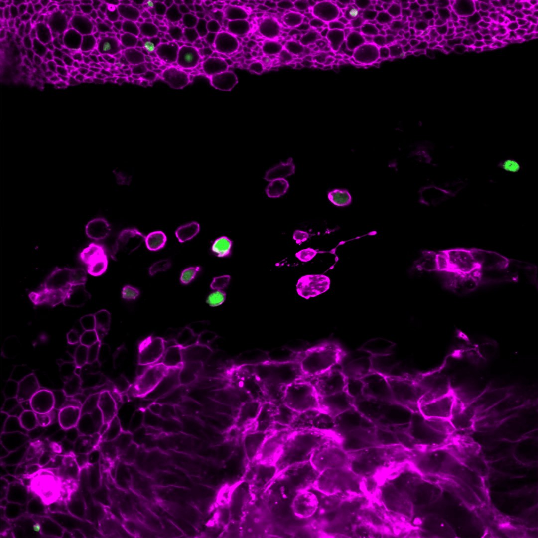 IRBBarcelona's tweet image. ❄️Le'ts celebrate #February with this 🔝 #ImageoftheMonth from our calendar!

📸"Breaching Boundaries", by @KaustuvGhosh1, from @MarcoMilanIRB's lab.

🔬Wild-type epithelial cells (upper) &amp;amp; tumorigenic cells (lower), membranes in🟣magenta &amp;amp; caspase reporter in🟢green.

#WeAreIRB
