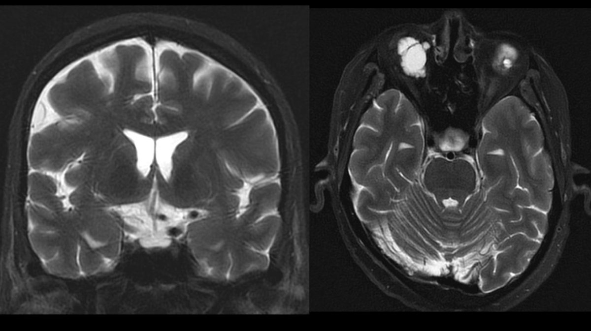 Bejoy Thomas tweet media