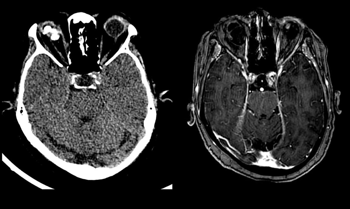 Bejoy Thomas tweet media