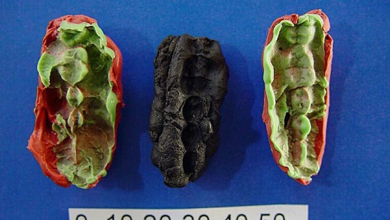 Des chewing-gums préhistoriques révèlent les secrets de leurs propriétaires ➡️ l.franceinter.fr/T1u Explications @Daniel_Fievet