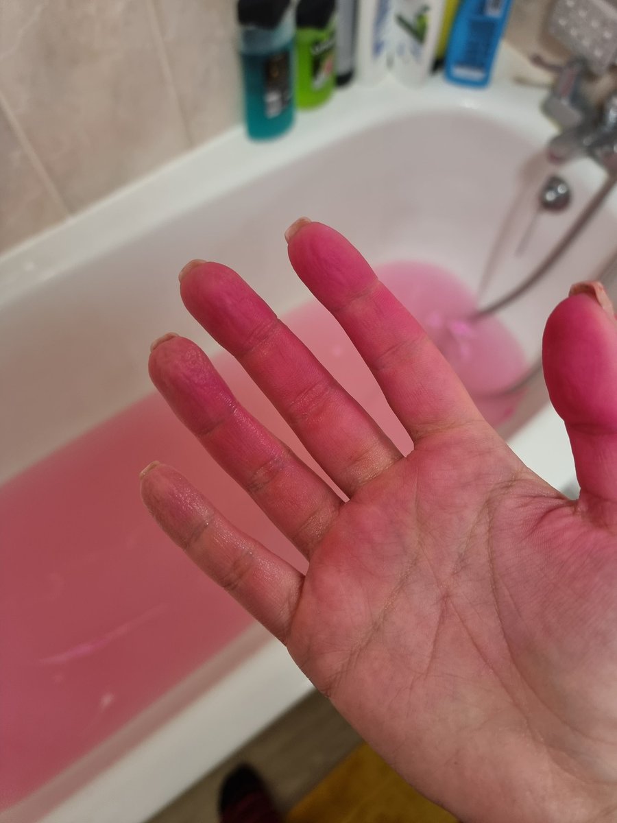 Uh, <a href="/LushLtd/">LUSH UK</a> Im pretty sure your bath bombs shouldn't turn my skin PINK. Help. 😭😫 I've scrubbed and exfoliated and it's not fading. 😫