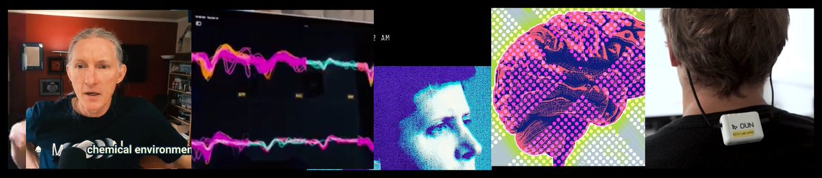 neurosock's tweet image. AI x Brain Chips are developing shockingly fast.

Just in January:
- €33M for German BCI startup
- OpenAI $51M brain inspired chips
- $19M for Motif
- 10.000 electrodes might be close
- China hot on B-Chips
- Build BCIs with Python
- Neuro IMDB

Here&apos;s what you need to know: