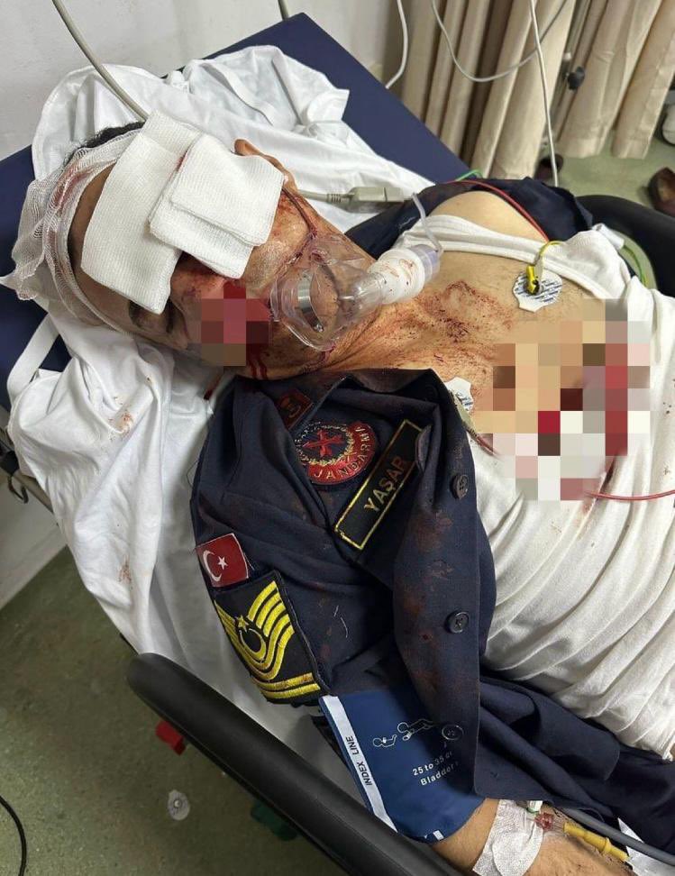 izzetcapa's tweet photo. …
Olay yeri Erzurum Pasinler…
Fotoğraftaki kişi ise kavga ihbarına giden ve yaralı vatandaşı ambulansa taşıyan Astsubay Mustafa Yaşar…
O esnada H.K. isimli bir şahıs kafasına taş fırlatıyor…
Astsubay Yaşar’ın sol elmacık kemiği yirmi parçaya kırılıyor…
Sol gözü parçalanarak kör oluyor…
Burnu üç yerinden kırılıyor ve kafatasında da kırıklar oluşuyor…
Beyni su topluyor…
Peki bunu yapan H.K ne oldu derseniz…
O da adli kontrolle serbest bırakılıyor…
Yaşasın yüce Türk adaleti…