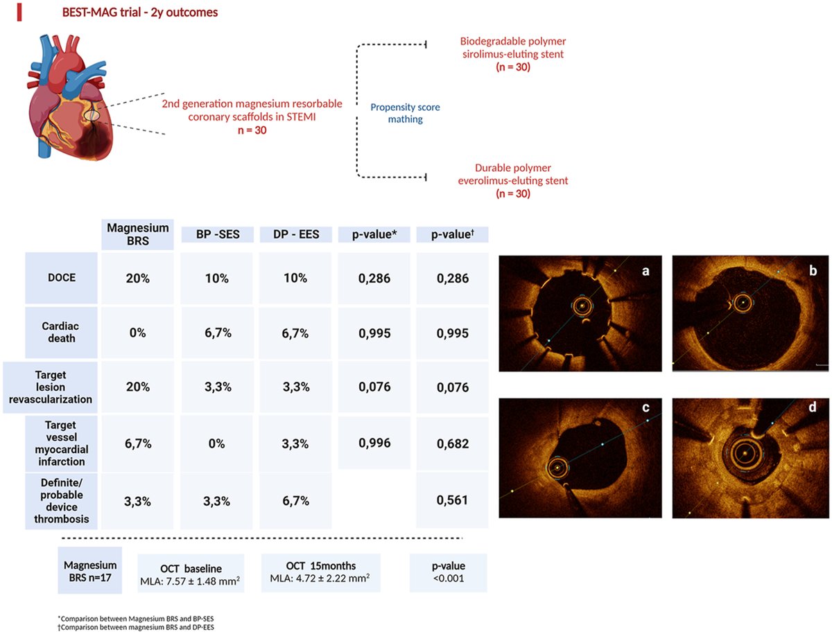 Hellenic Journal of Cardiology (@hjcardiology) on Twitter photo Resorbable magnesium scaffolds: Is a new player in #STEMI treatment? The BEST-MAG trial shows comparable efficacy to #DES
Free online: bit.ly/HJC_bestMAG-ST…
@hjc_Ed <a href="/LKoliastasis/">Leonidas Koliastasis</a> <a href="/panosxap/">Panos Xaplanteris</a> <a href="/IoannisSkalidis/">Ioannis Skalidis</a> <a href="/BertVandeloo/">Bert Vandeloo</a> <a href="/picard_fabien/">Fabien Picard 🩺</a> <a href="/ThomPilgrim/">Thomas Pilgrim</a> <a href="/JuanFIglesias1/">Juan F. Iglesias</a> @qdehempt Resorbable magnesium scaffolds: Is a new player in #STEMI treatment? The BEST-MAG trial shows comparable efficacy to #DES
Free online: bit.ly/HJC_bestMAG-ST…
@hjc_Ed <a href="/LKoliastasis/">Leonidas Koliastasis</a> <a href="/panosxap/">Panos Xaplanteris</a> <a href="/IoannisSkalidis/">Ioannis Skalidis</a> <a href="/BertVandeloo/">Bert Vandeloo</a> <a href="/picard_fabien/">Fabien Picard 🩺</a> <a href="/ThomPilgrim/">Thomas Pilgrim</a> <a href="/JuanFIglesias1/">Juan F. Iglesias</a> @qdehempt