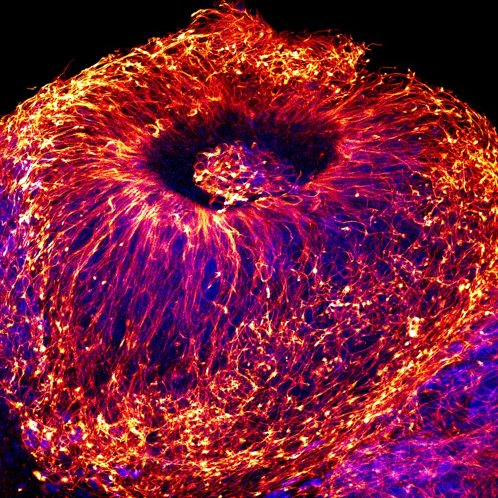CarlesSaura's tweet photo. Ana Gutierrez (Idibell) @miriplass Group amb la imatge “Volcano” és la guanyadora del concurs del #XIIISimposideNeurobiologia  #NeuroSCB2024 @SCB_iec cultiu 3D de neuronas en estructura de roseta durant la maduració de neuroesferes (vermell: TUJ1).  👏👏👏 https://t.co/v5RHpAEDfG