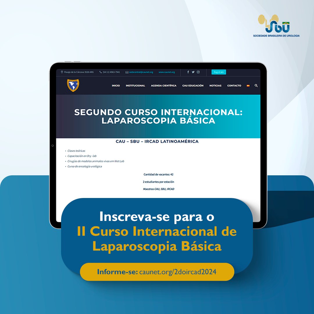 Increva-se no II Curso Internacional de Laparoscopia Básica, realizado em parceria entre CAU, SBU e IRCAD.

👉São 42 vagas e dois alunos por estação.

O treinamento será nos dias 4 e 5 de março em São Paulo.

Saiba mais em: caunet.org/2doircad2024/ 

#SBU #cursos #urologia