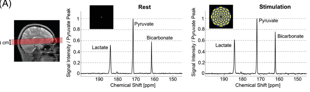 fMRI with #hyperpolarized #MRI shows increased metabolism under visual stimulation. This is a completely new way to look at brain function. Congrats to @JaeMoPark1 @UTSW_Radiology team on devising this clever study! onlinelibrary.wiley.com/doi/10.1002/mr…