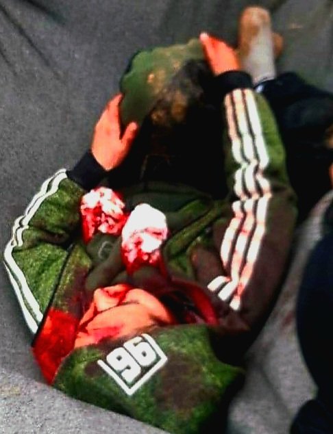 Gözlerden uzak, #PKK'nın kontrolünde olan El Hol kampı, kadın ve çocuklar için bir açık hava hapishanesine dönüşmüş durumda. PKK tarafından çocukların öldürülmesi, vicdanları bu bölgeye çevirmelidir. Ülkeler vatandaşlarını geri alarak bu trajediye son vermeli.
#PkkBebekKatilidir