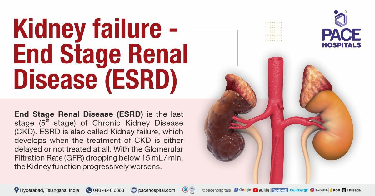 NikWinaj's tweet photo. Hey! Back again. I'm Nikyah, from Cleveland, Ohio. I am in need of a kidney transplant, due to End Stage Renal Failure. My doctors said I should give social media another try to spread awareness. My blood type is O+! PLEASE RESHARE❤️ THANK U! https://t.co/O2baTNHoOo