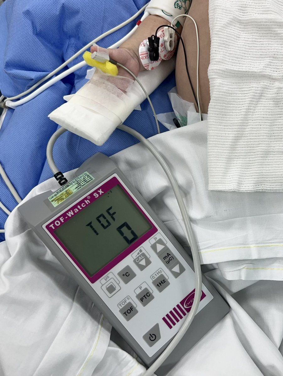 NAPEN Anestesiologia USP (@napen_icr) on Twitter photo This year marks the 45th anniversary of Viby-Mogensen's seminal study on residual curalization. There is no better way to celebrate than using the neuromuscular junction monitor! #PedsAnes <a href="/anestesia_usp/">Anestesiologia USP</a> <a href="/ricardovieirac/">ricardo vieira</a> This year marks the 45th anniversary of Viby-Mogensen's seminal study on residual curalization. There is no better way to celebrate than using the neuromuscular junction monitor! #PedsAnes <a href="/anestesia_usp/">Anestesiologia USP</a> <a href="/ricardovieirac/">ricardo vieira</a>