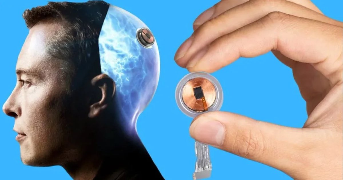 Akbar843302Ali's tweet image. the first human has a Neuralink brain implant! 🌐💡 Imagine controlling computers with your thoughts! 🤯 Would YOU dive into the future with this? 🤖✨ #NeuralinkRevolution #MindControlTech #FutureTech