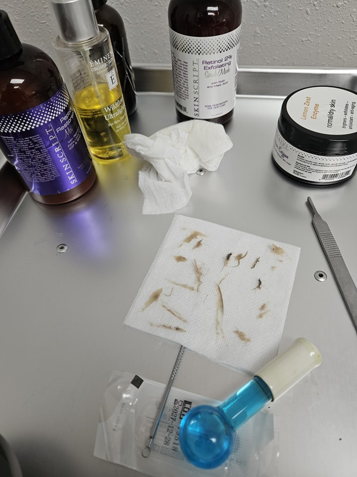 BareBlissYakima's tweet photo. Dermaplaning + Extractions + Enzyme Peel = Smooth, Bright, Glowing Skin. โจ๏ธ 509-961-6555 #dermaplaning #radiantskin #barebliss #healthyskin #smoothskin #beauty #skinrejuvenation #skinrenewal #loveyourskin #yakima #vibrantskin #glowingskin #skinbrightening #dermaplane https://t.co/9UB2PcAaT2