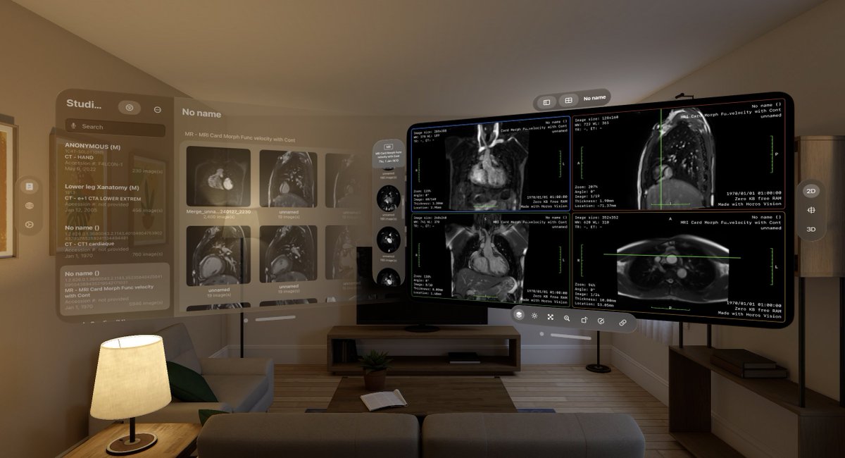 falcon_vue's tweet image. 🖐️Experience intuitive interaction with Falcon Vue. Medical imaging is now more natural than ever. #falconVue #MedicalImaging #Innovation #AppleVisionPro
